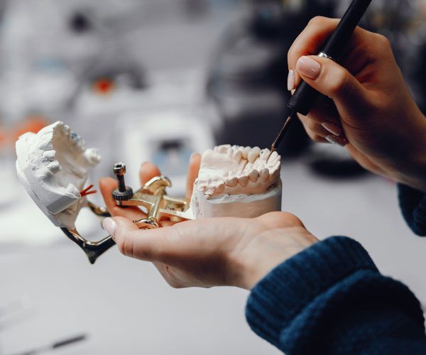 Plastic jaw in the dentist's office. The doctor holds in the hands of dental implants.